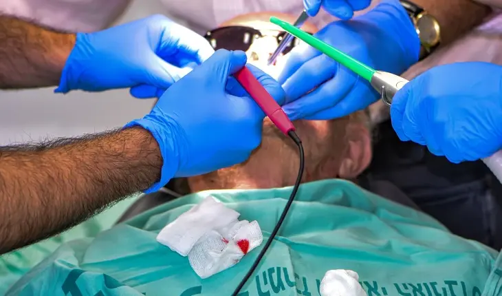 Chirurgie Orală
