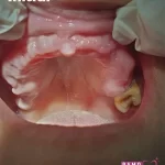 Portofoliu lucrare cabinet de stomatologie in Timisoara - Ramodent Praxis
