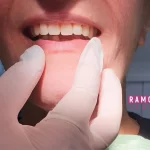 Portofoliu lucrare cabinet de stomatologie in Timisoara - Ramodent Praxis